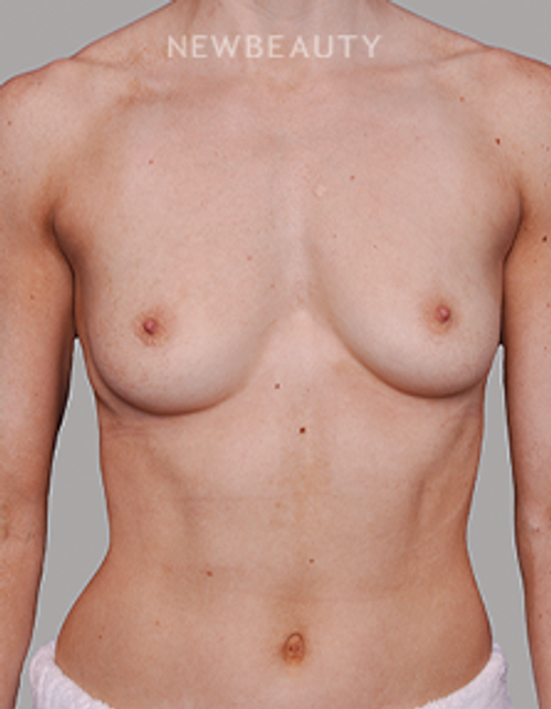 Dr. Alan J. Durkin - Volume Boost - 23763561 - Before