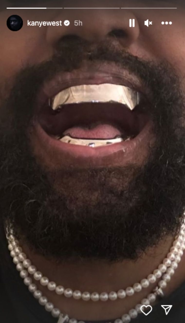 Metallic teeth inside Kanye West's mouth