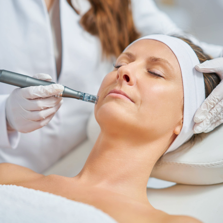 microneedling for neck wrinkles