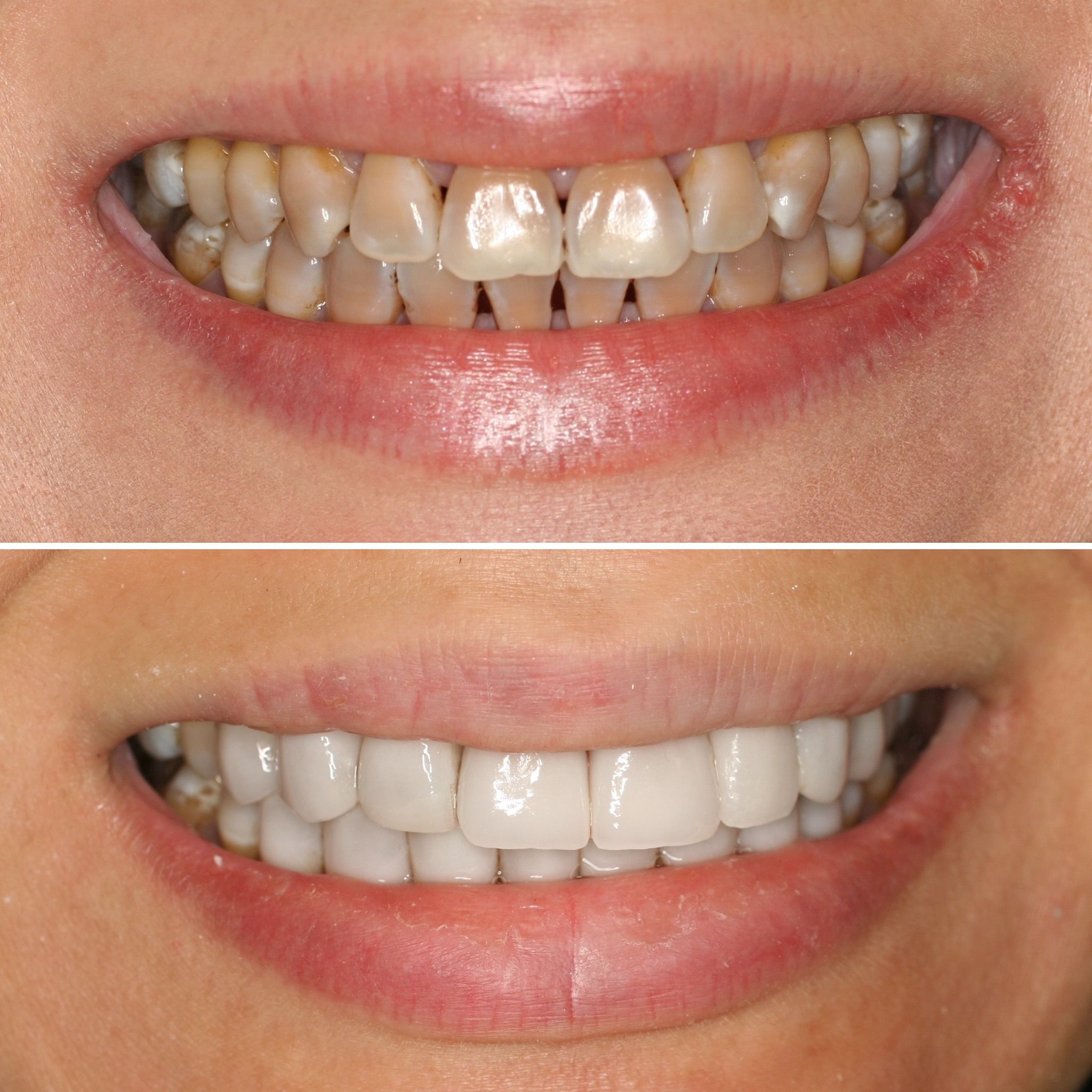 A Smile to Fall in Love With