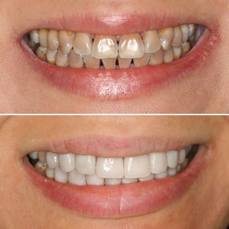 A Smile to Fall in Love With