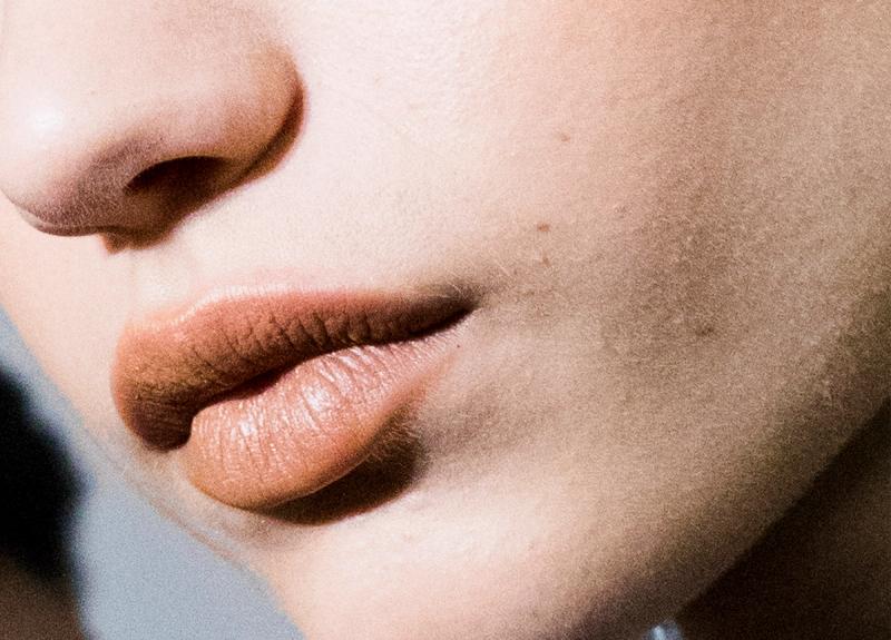 Swelling, Bumps and Bruises: What Is Considered ‘Normal’ When Getting Your Lips Done