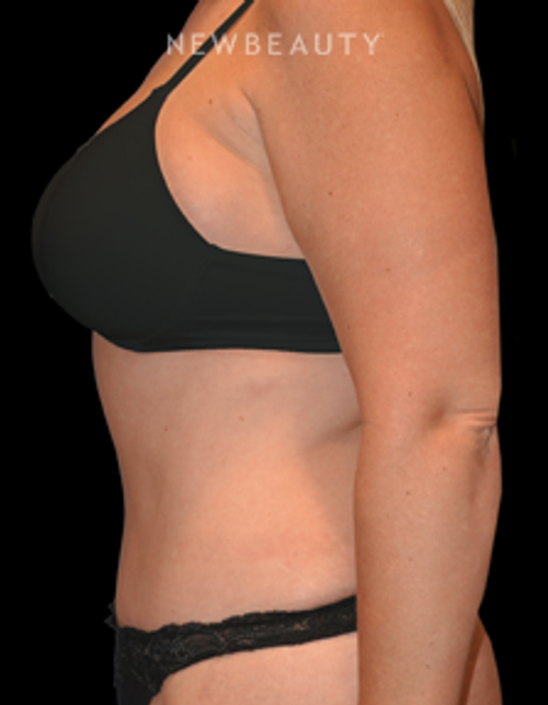 Dr. Bryan W. Gawley - A Slender Shape - After