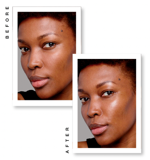 SKINVIVE by Juvéderm