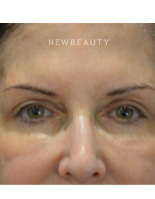 Dr. B. Aviva Preminger - Aging Gracefully - After