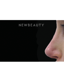 Dr. Julie Russak, Injectables & Fillers - After