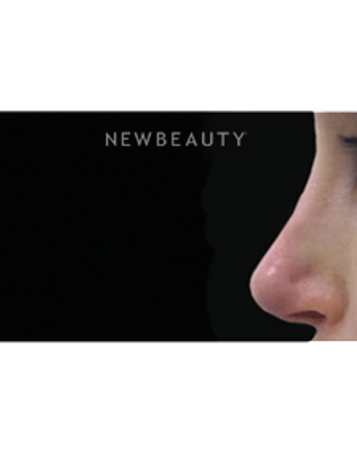 Dr. Julie Russak, Injectables & Fillers - After