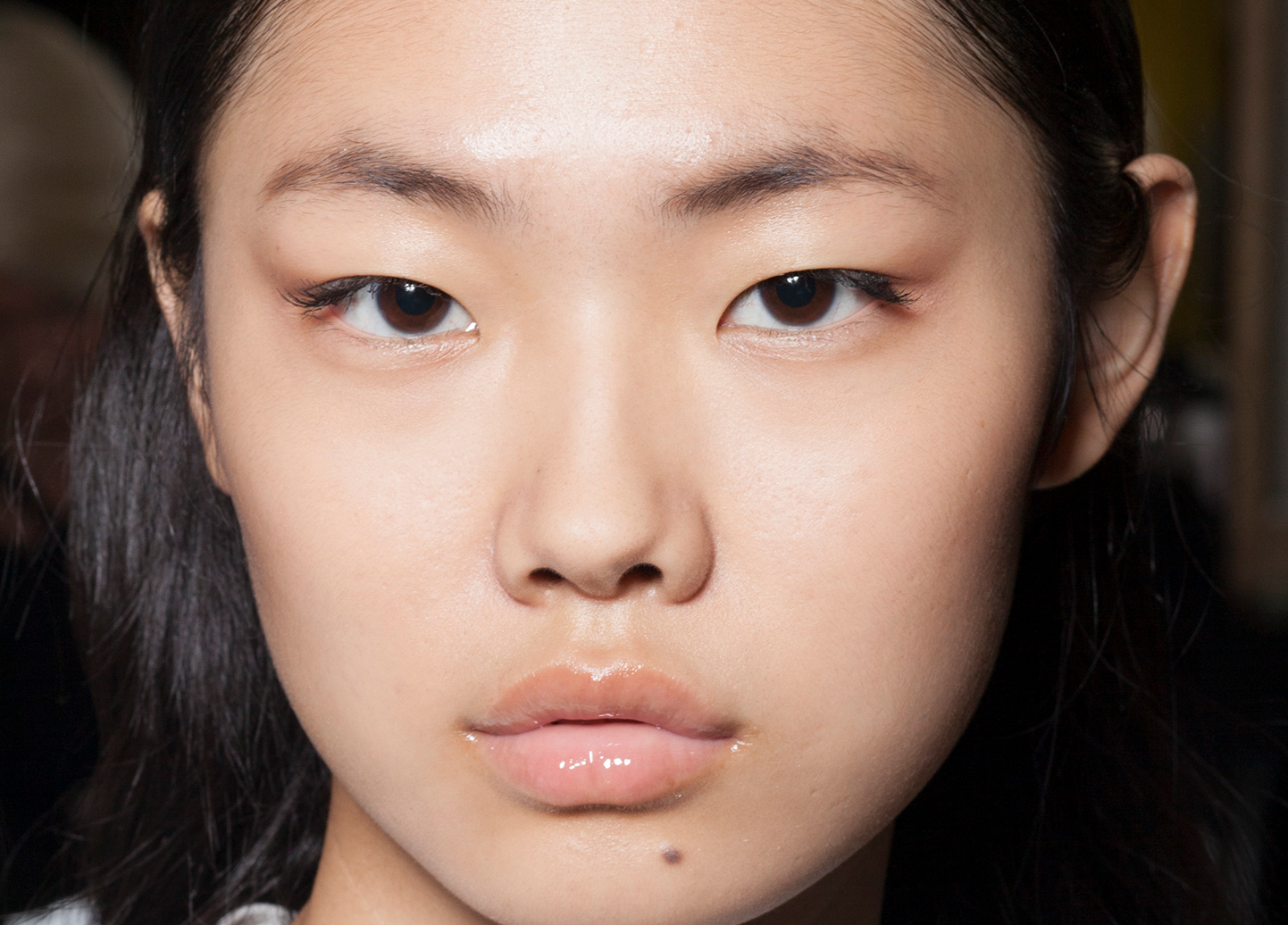 Teens Are Using Hyaluron Pens to Self-Inject Hyaluronic Acid on Social Media