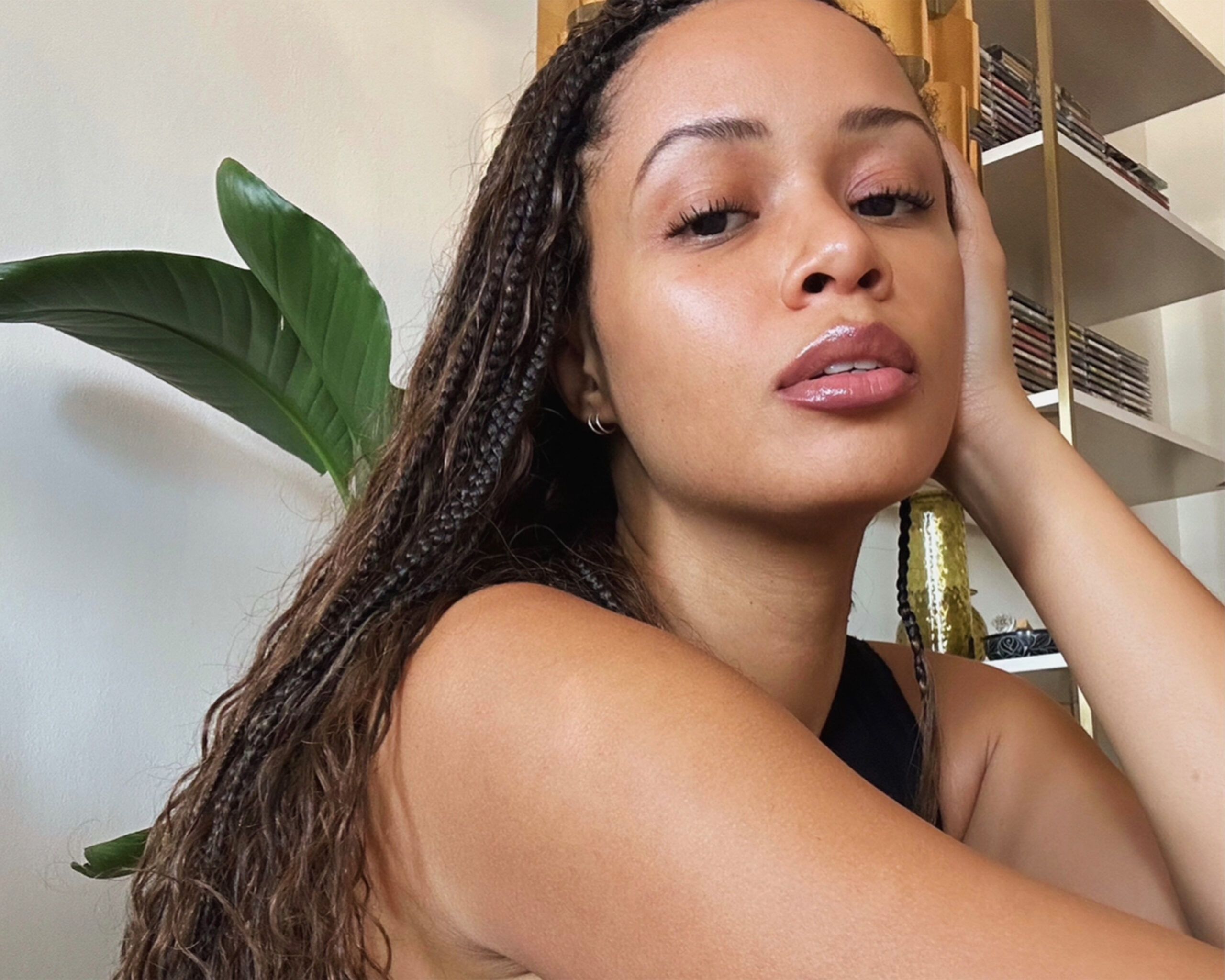 How I Treat Hyperpigmentation from Head-to-Toe