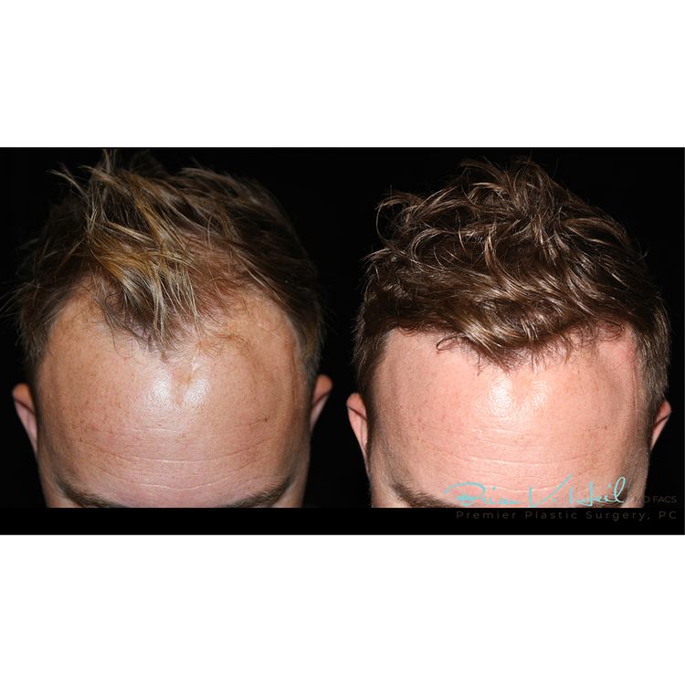 Pittsburgh plastic surgeon Brian V. Heil, MD