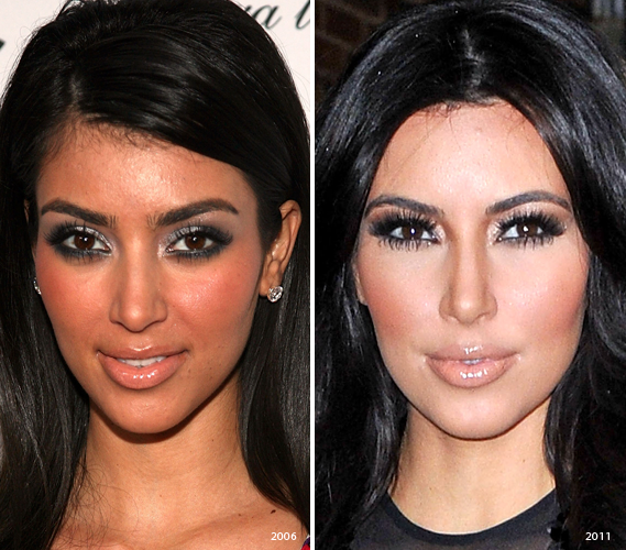 Kim Kardashian