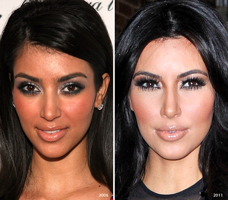 Kim Kardashian