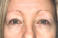 Dr. David Schlessinger - A New Outlook - Before