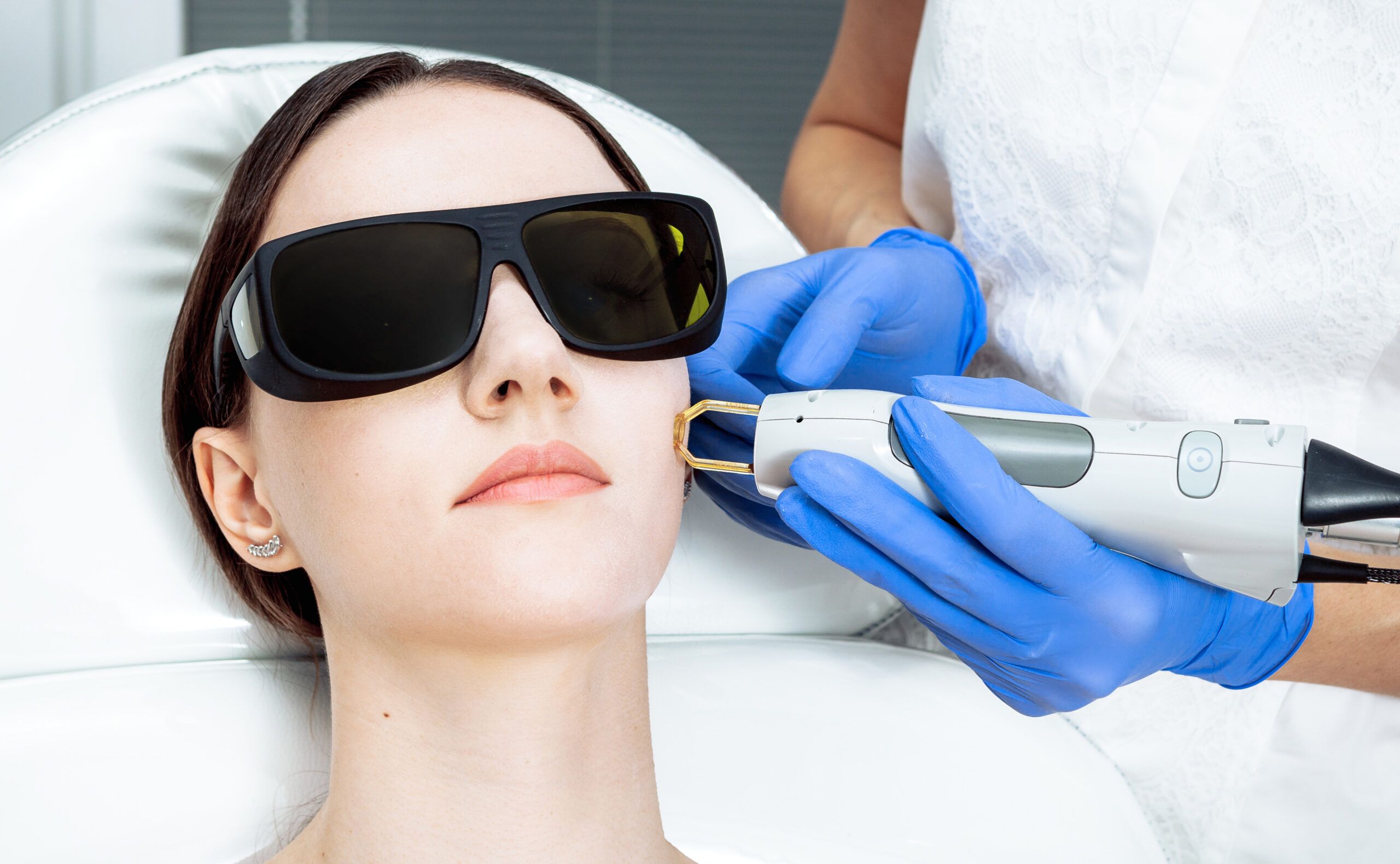 laser skin treatment