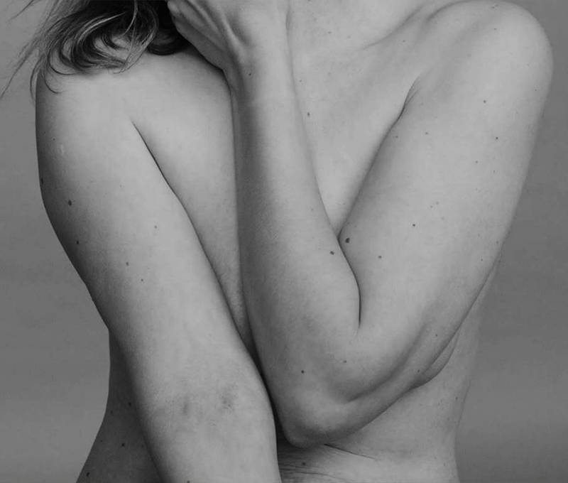 Why Is Liposuction Blowing Up Right Now?