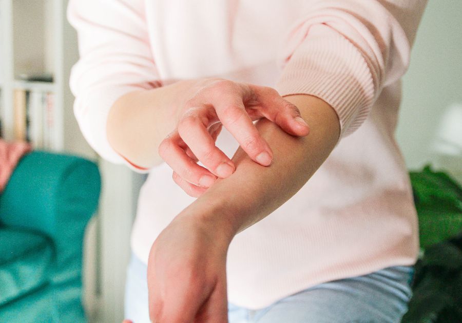 woman with eczema itching skin