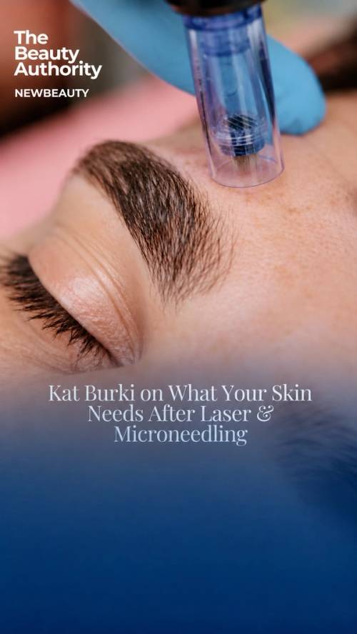 Kat Burki on Skin Recovery After Laser Treatments