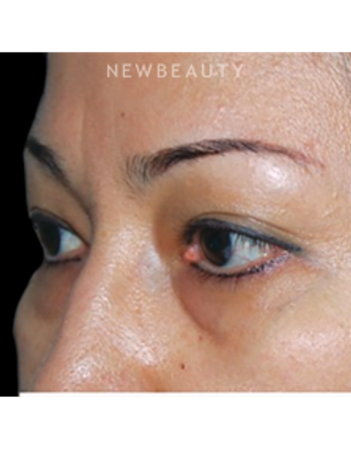 Dr. Roman Rayham - Restoring a Natural Look - Before