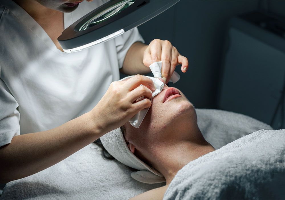 How to Properly Remove Blackheads at Home