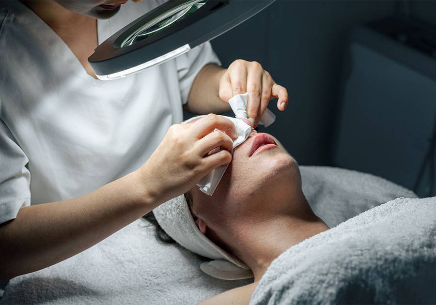How to Properly Remove Blackheads at Home
