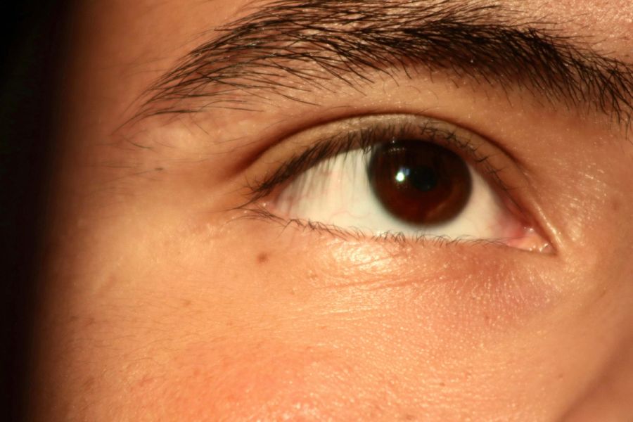 woman's eye area