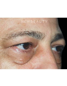 Dr. Roman Rayham - A Bright New Look - Before