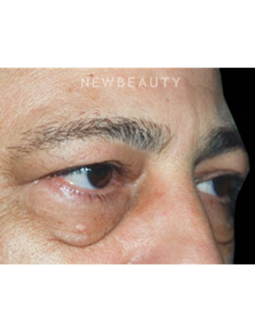 Dr. Roman Rayham - A Bright New Look - Before