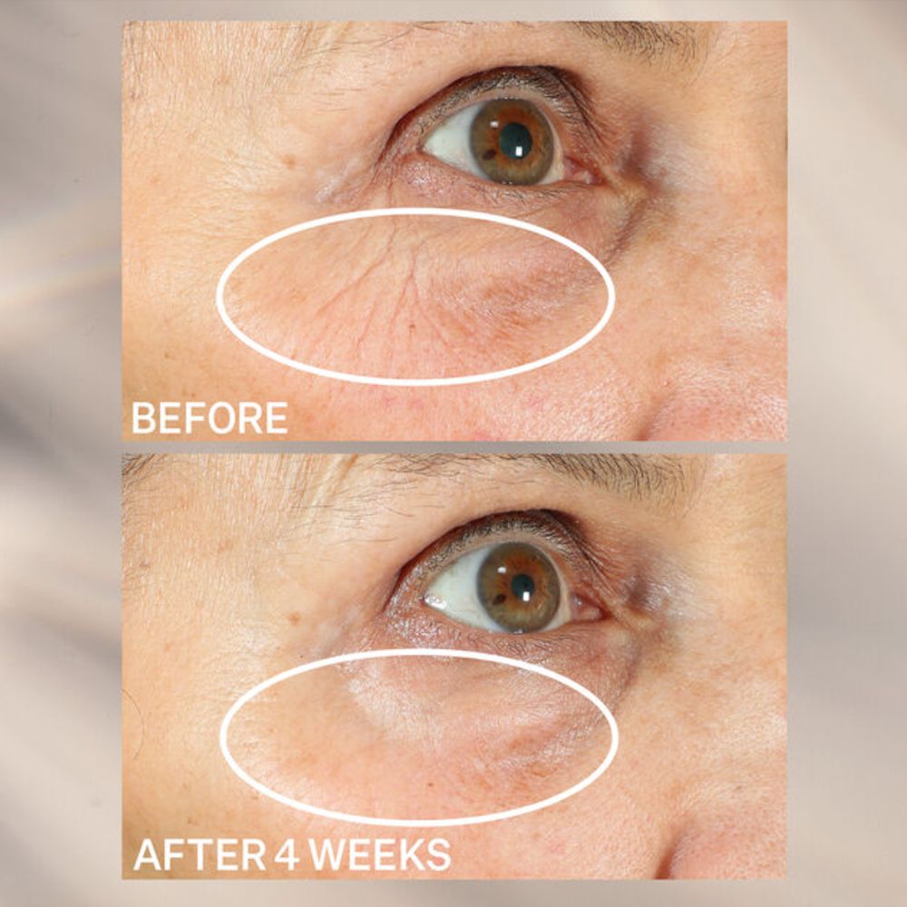 StriVectin Peptight 360˚ Tightening Eye Serum ($72)