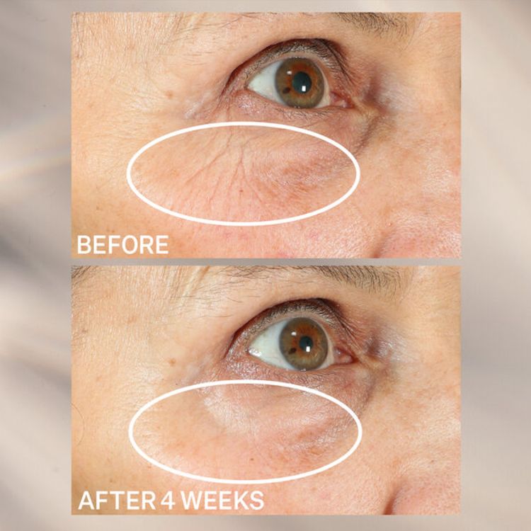 StriVectin Peptight 360˚ Tightening Eye Serum ($72)