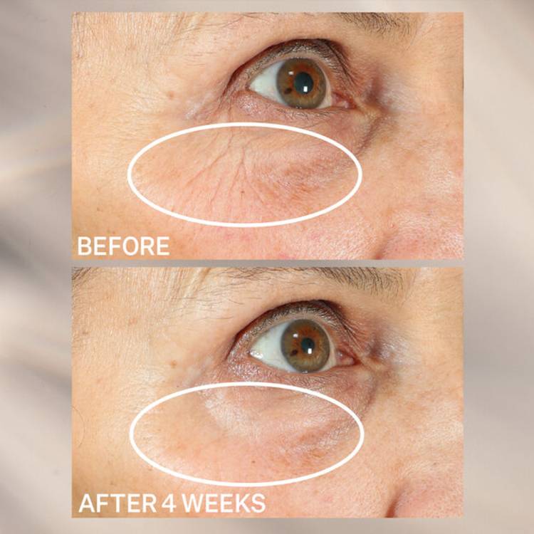 StriVectin Peptight 360˚ Tightening Eye Serum ($72)