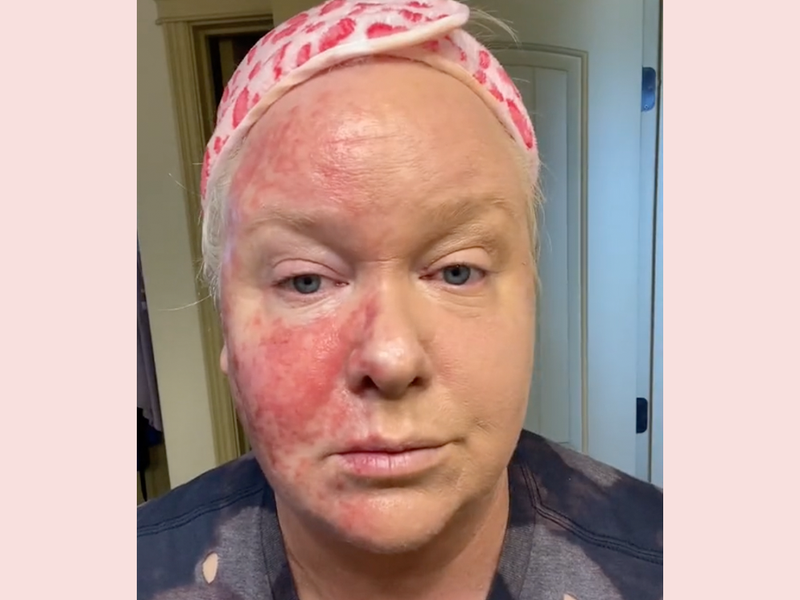 This Color-Correcting Foundation Is Going Viral on TikTok