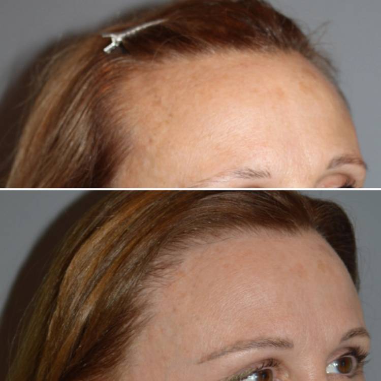 Beverly Hills, CA facial plastic surgeon Natalie Attenello, MD