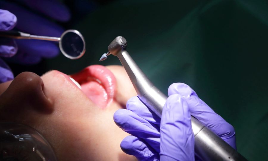 dental anxiety