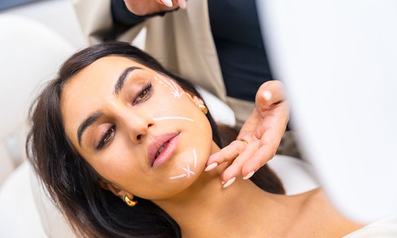 Woman with correcting lines painted on the face in a beautician clinic