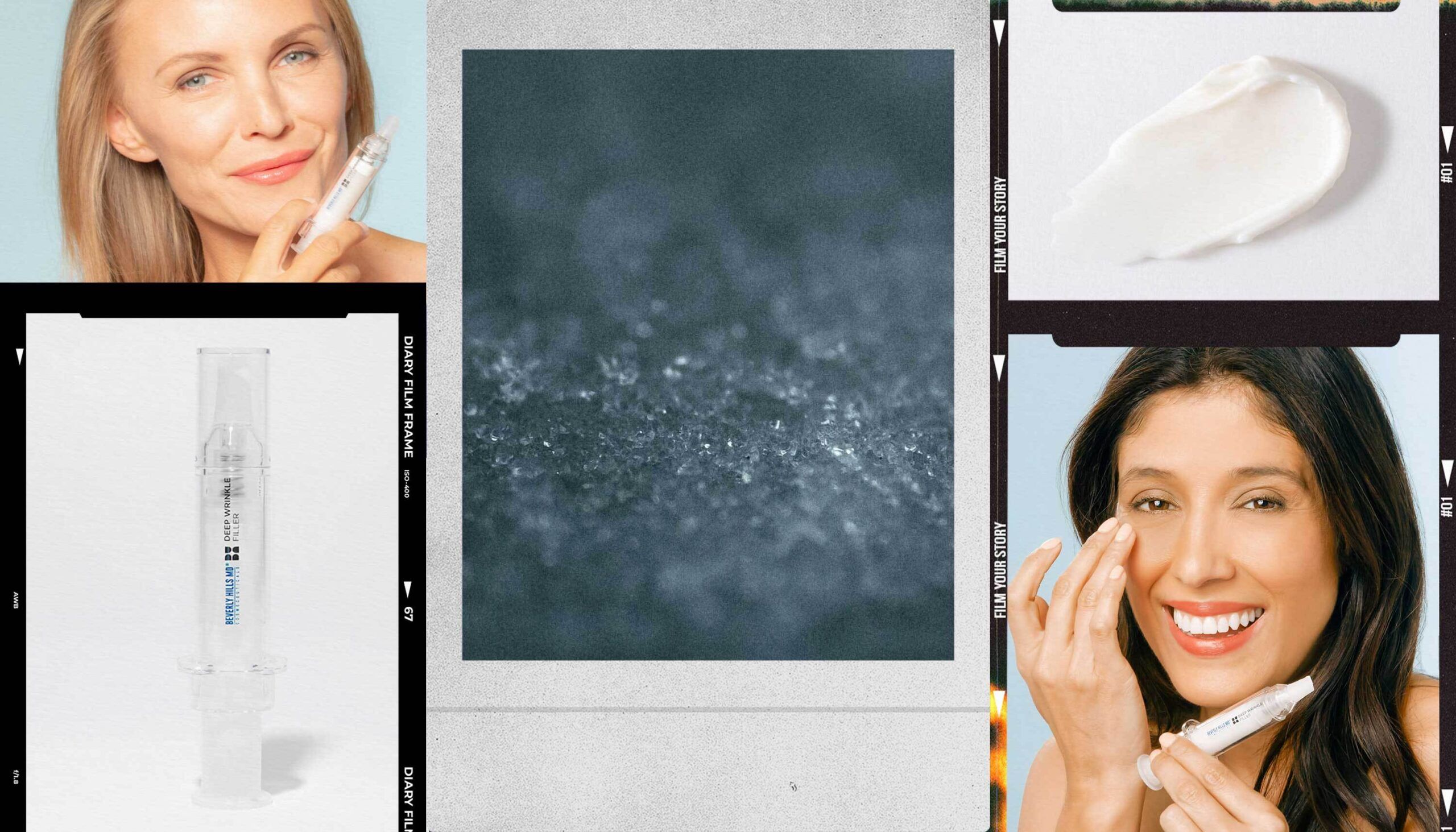 Beverly Hills MD Deep Wrinkle Filler