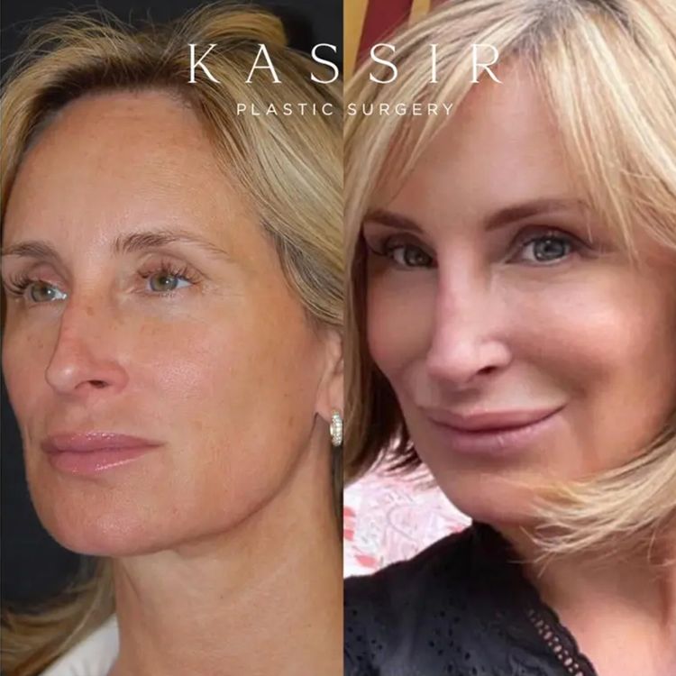 Sonja Morgan