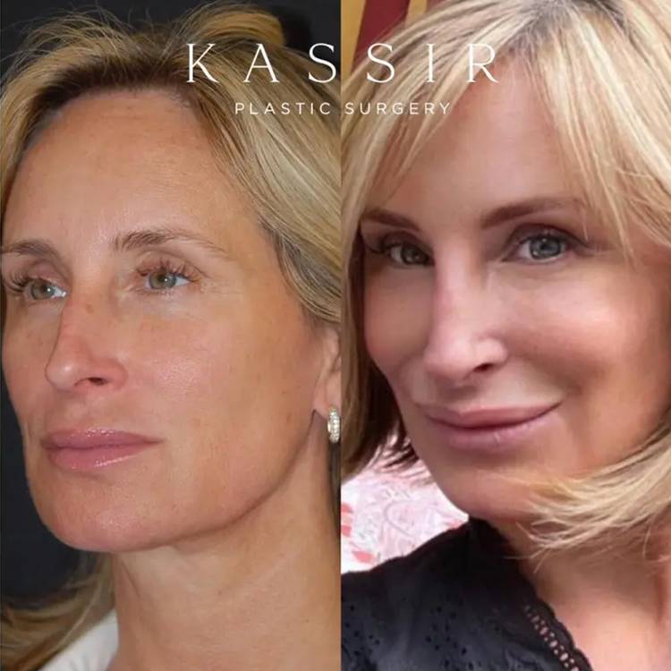 Sonja Morgan