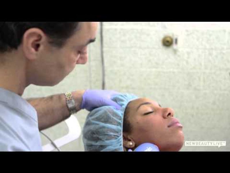Stop Aging Skin With Clear + Brilliant Laser Treatment