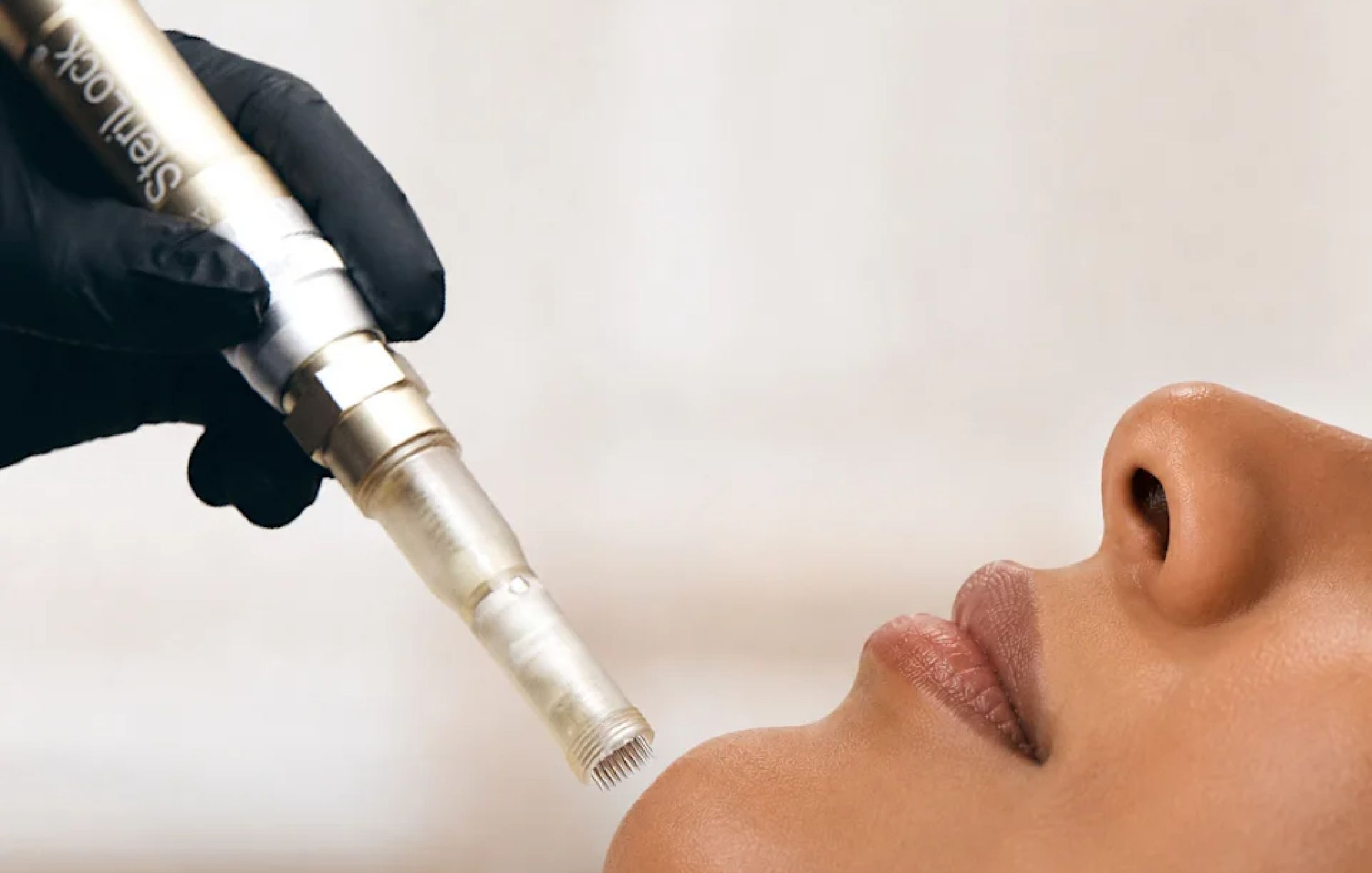 A gloved hand holds a SteriLock microneedling device close to a woman's lower face as she tilts her chin upward, mid-treatment.