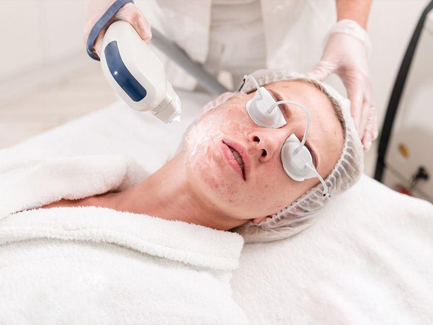 skin tightening procedure