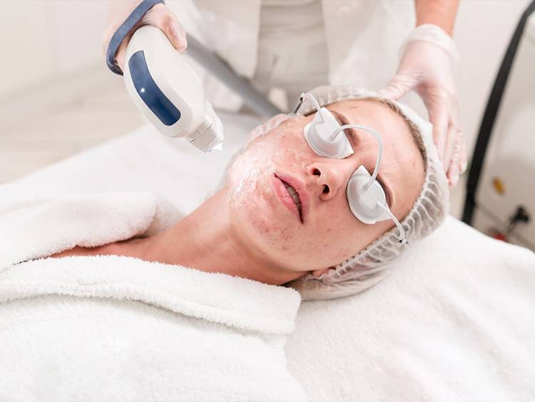 skin tightening procedure