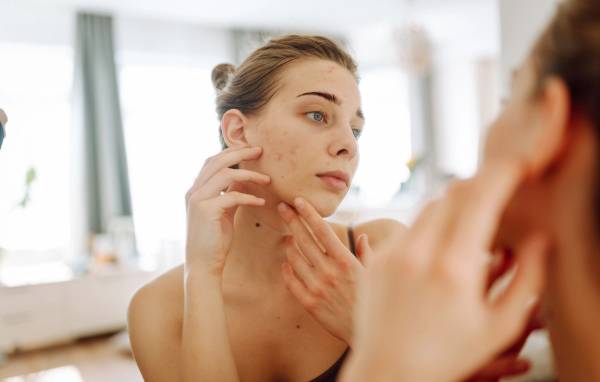 A woman examines acne on her cheek in a bathroom mirror.