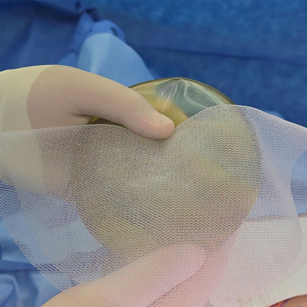 galaflex for internal bra