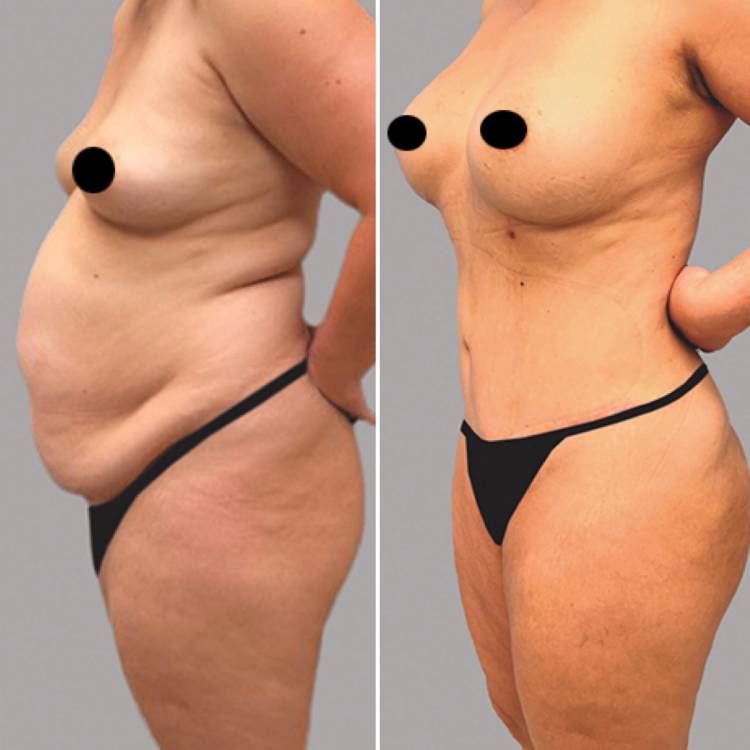 Short Hills, NJ plastic surgeon Mokhtar Asaadi, MD