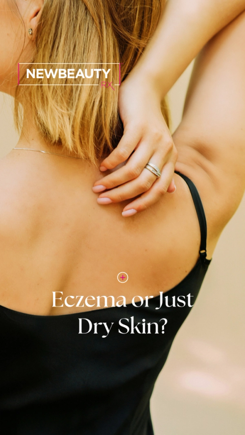 Eczema or Dry Skin? Dr. Anna Karp Explains