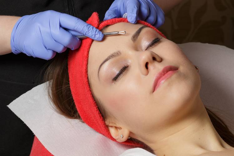 extractions