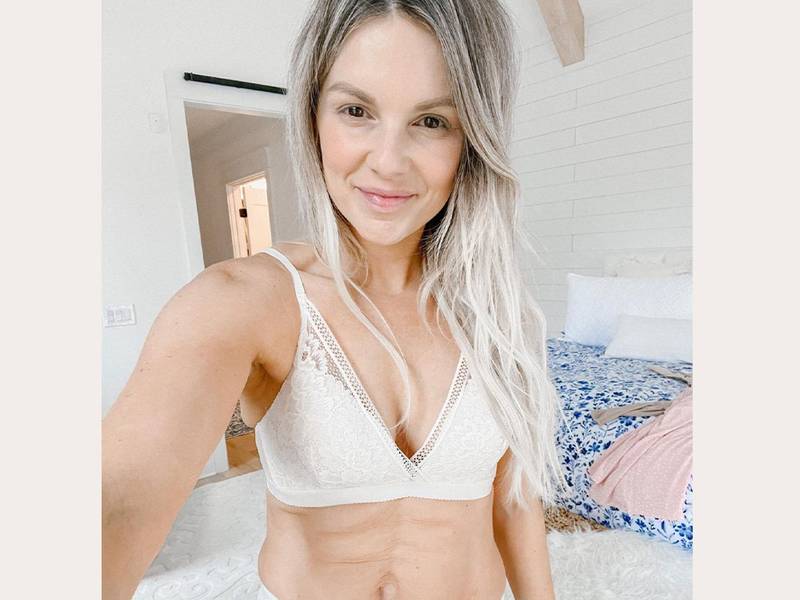 Ali Manno Says She ‘Thought About Getting Belly Button Surgery’—Here’s What That Entails