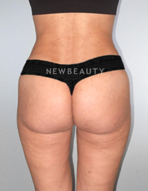 Dr. German Newall - Dramatic Transformation - After