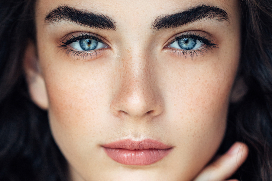 acneallergan