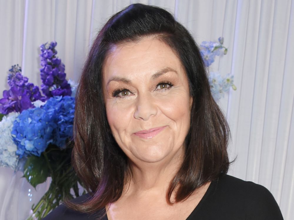 Dawn French Says She Is ‘Welcoming’ Her Gray Hair